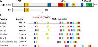 A syndrome featuring developmental disorder of the nervous system induced by a novel mutation in the TCF20 gene, rarely concurrent immune disorders: a case report